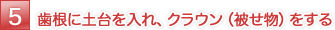 歯根に土台を入れ、クラウン（被せ物）をする